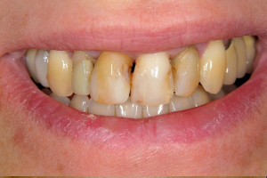 7Before